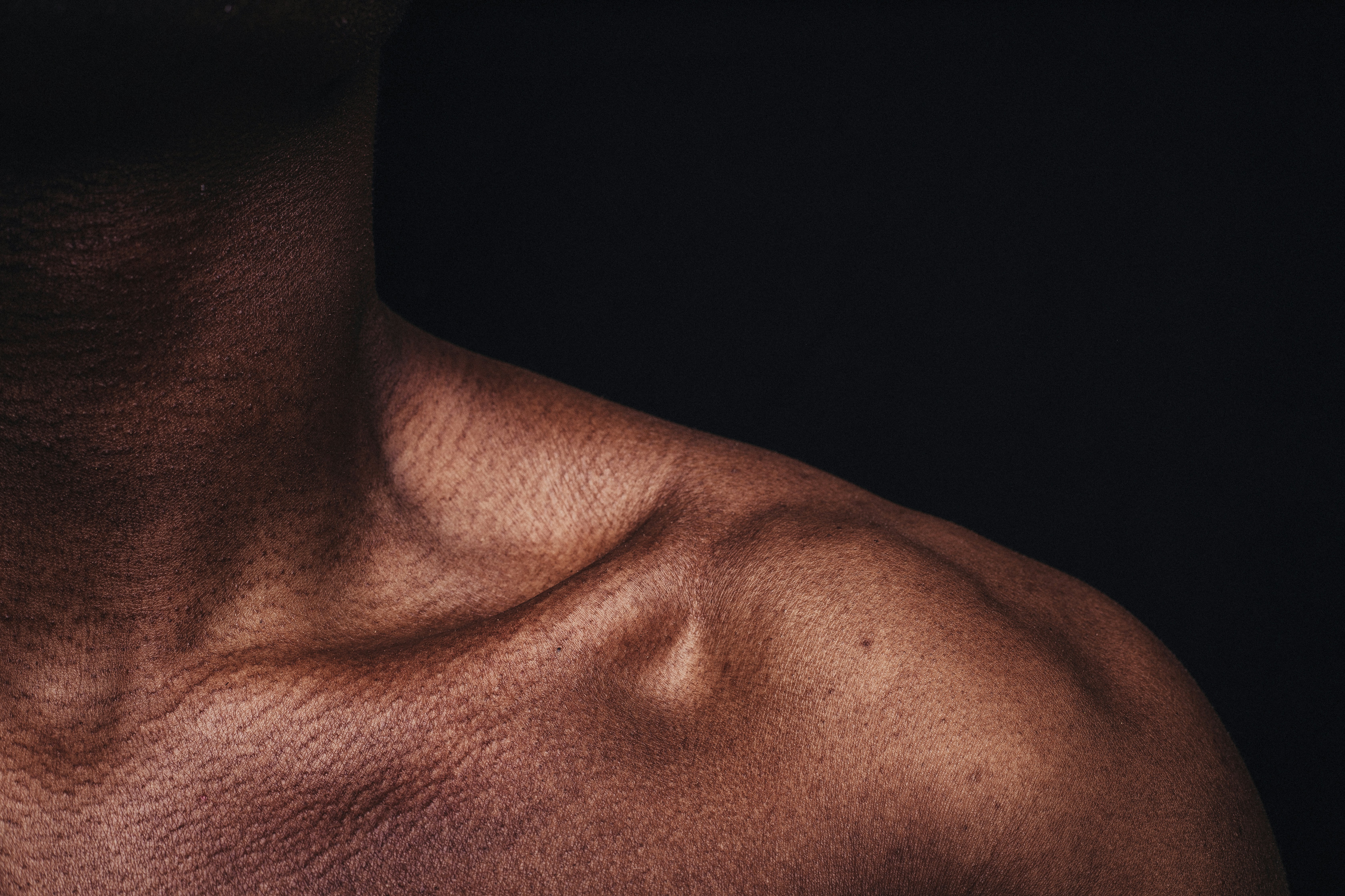 a person shoulder with recent dislocation