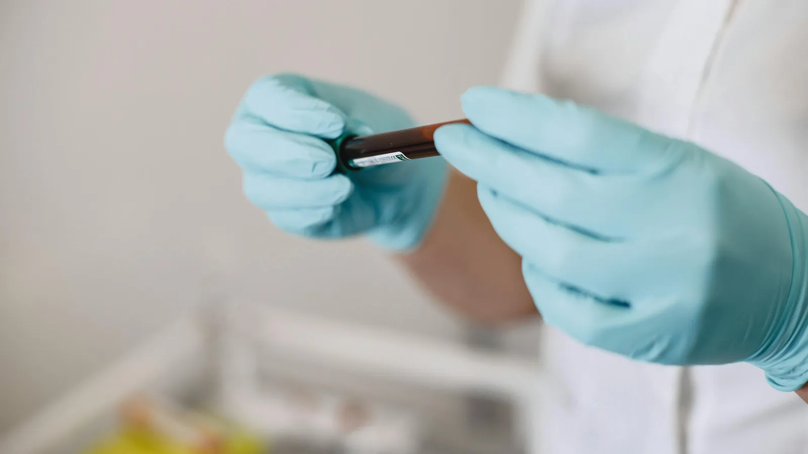 What Is Alkaline Phosphatase?