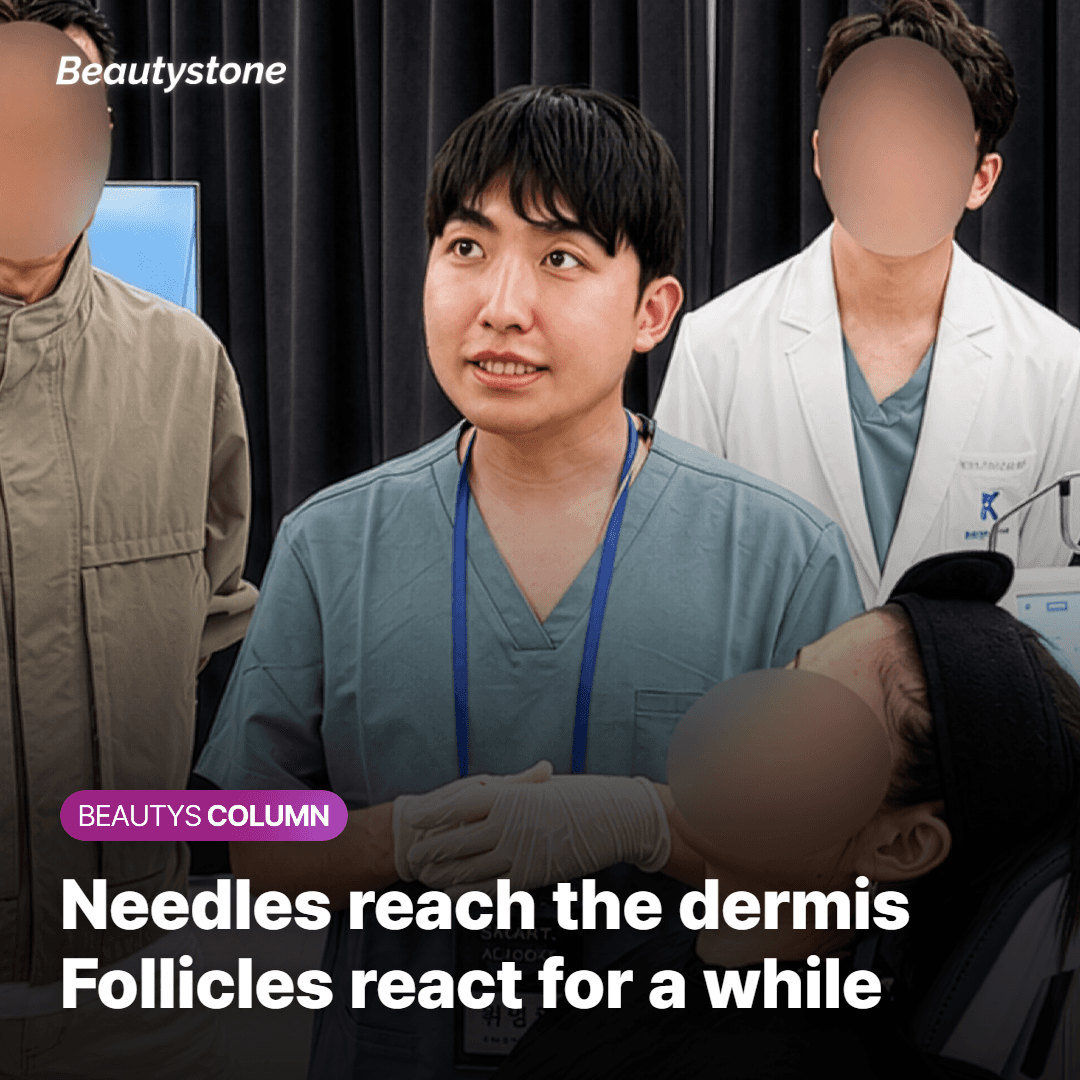Fine microneedles delivering radiofrequency heat into the dermis beside a hair follicle