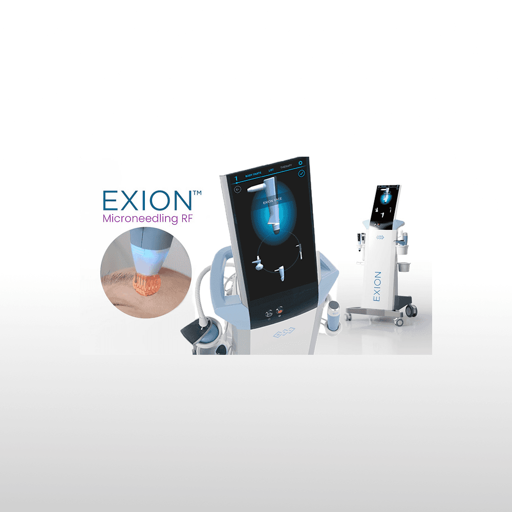 Exion rf microneedling