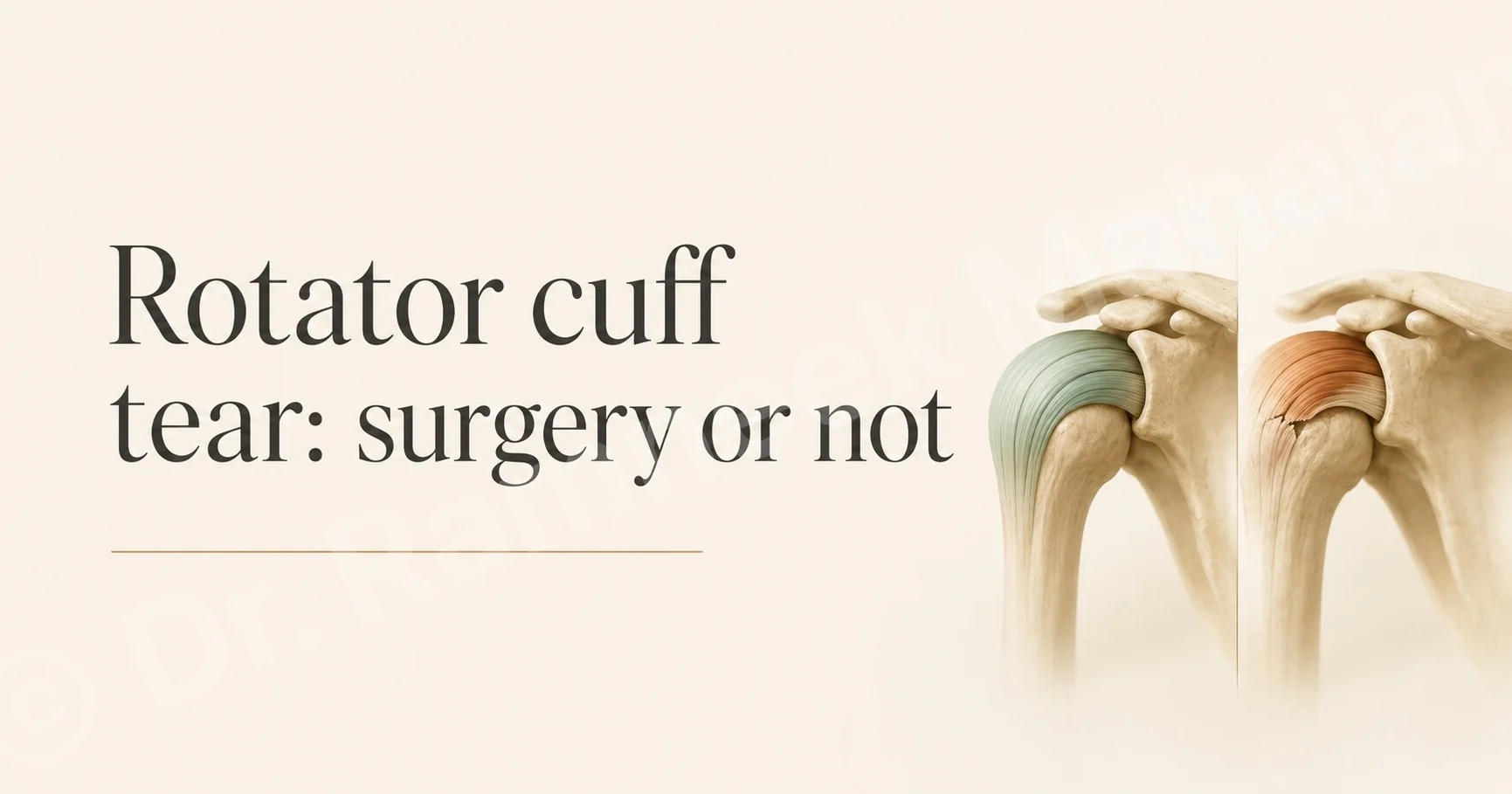 Dr Ramneek Mahajan's guide to rotator cuff tears: when they need surgery and when they do not.