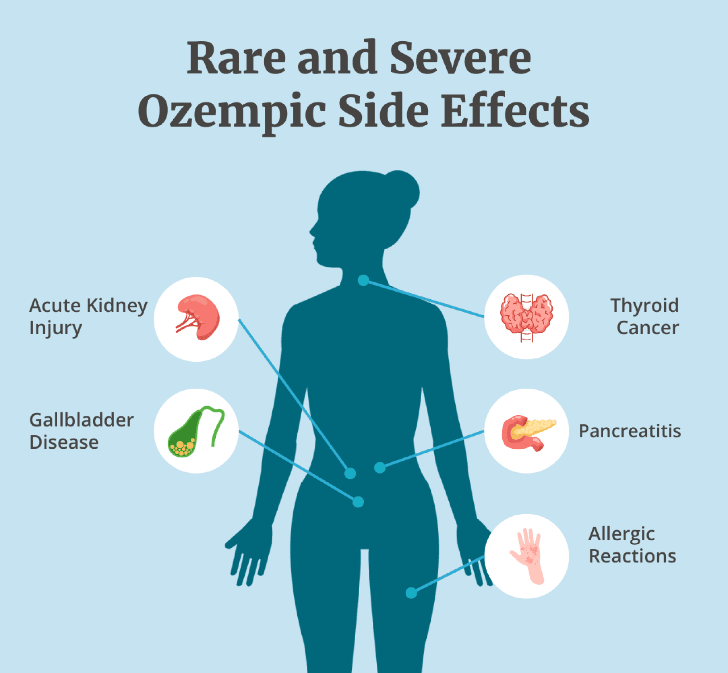 Infographic highlighting rare and severe Ozempic side effects