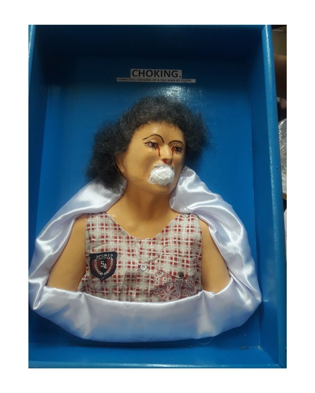 Choking (Homicidal Gagging of an Old Man by Cloth)