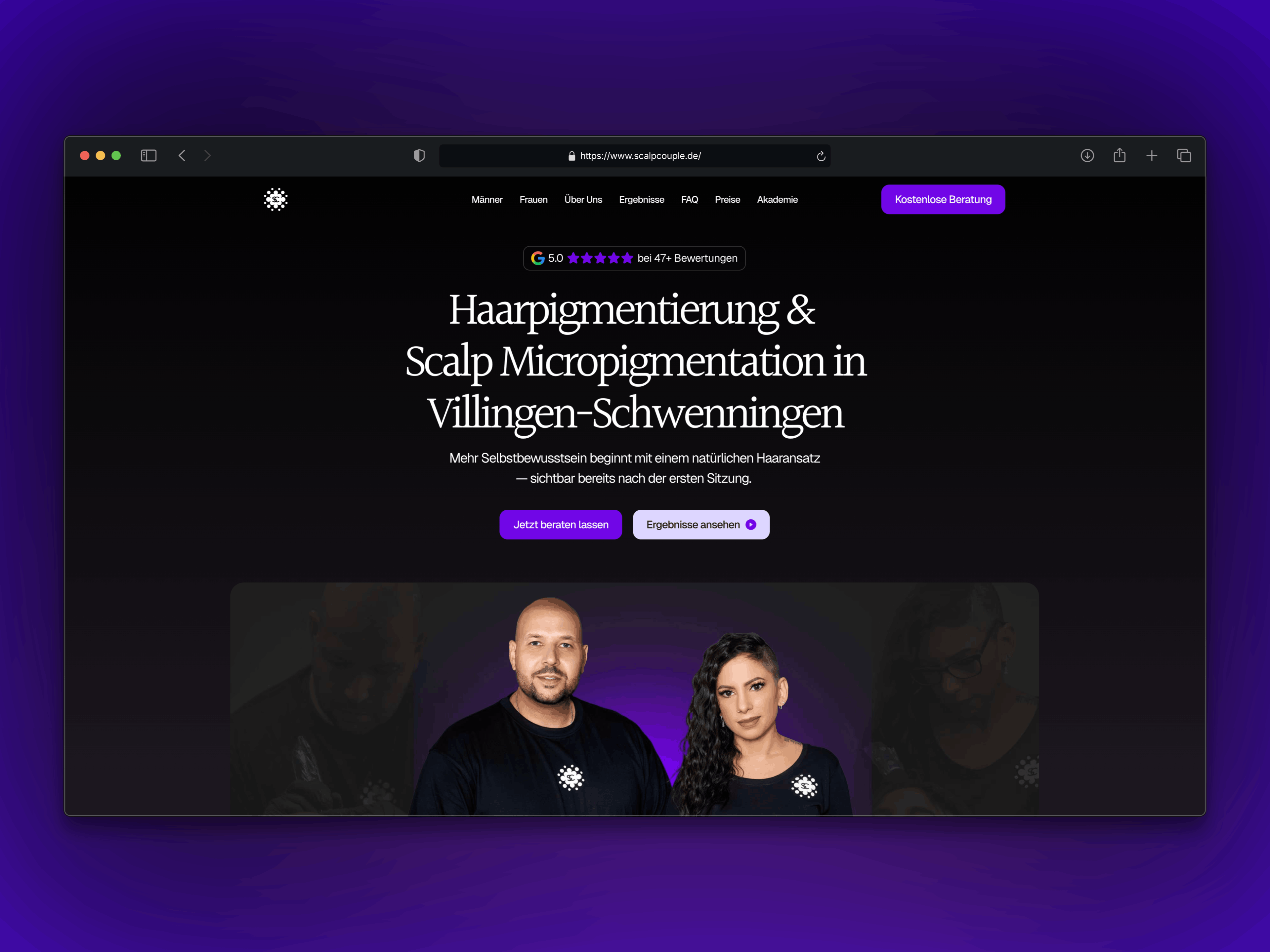 Scalp Couple Framer Website – Referenz Webnity X | Haarpigmentierung & SMP Studio