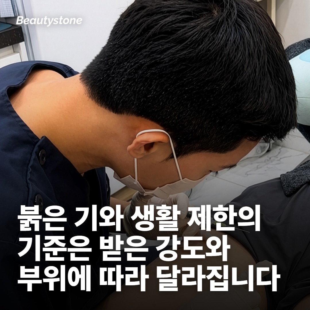 시술 후에 생기는 반응과 생활 제한