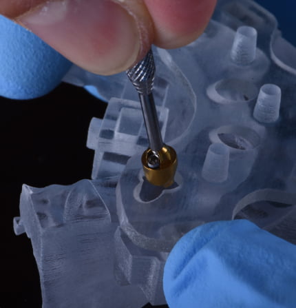 Digital Treatment Planning