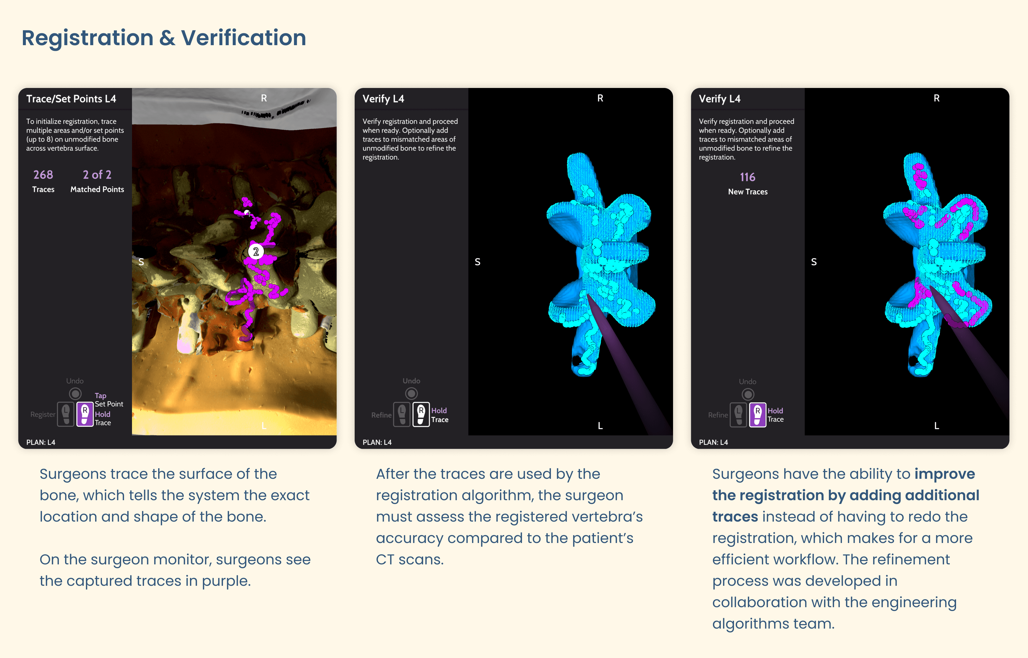 Description of registration and verification workflows with images from Paradigm SW