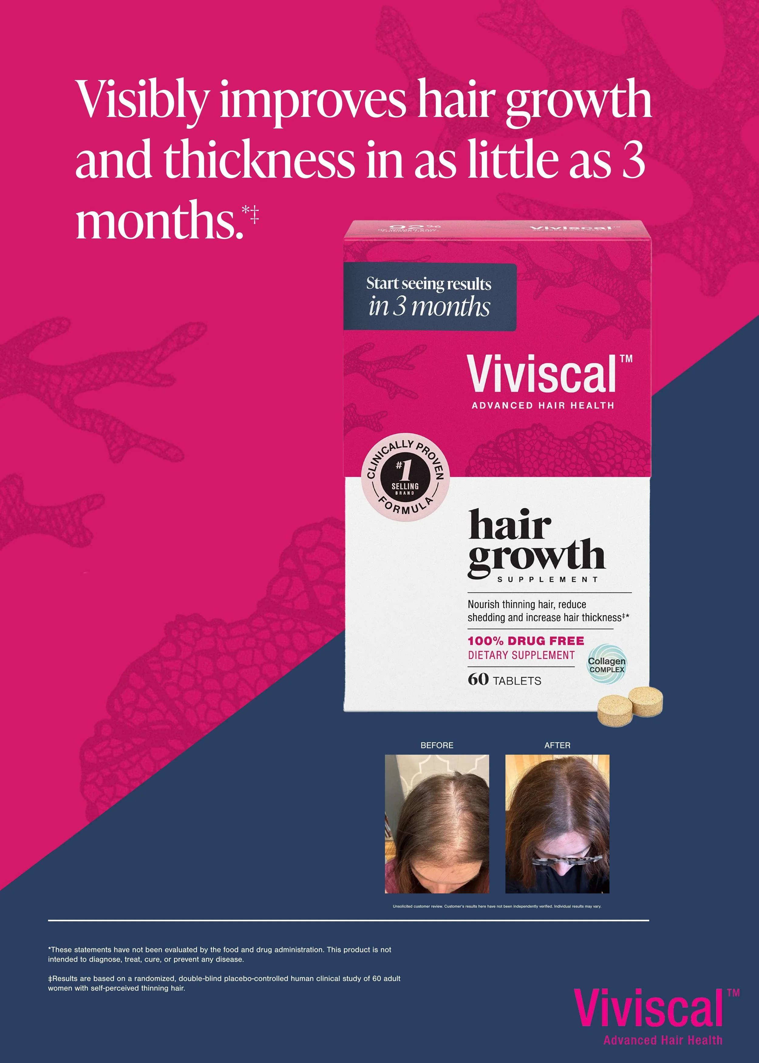 Viviscal menopause awareness campaign by Gamma Communications and Church and Dwight