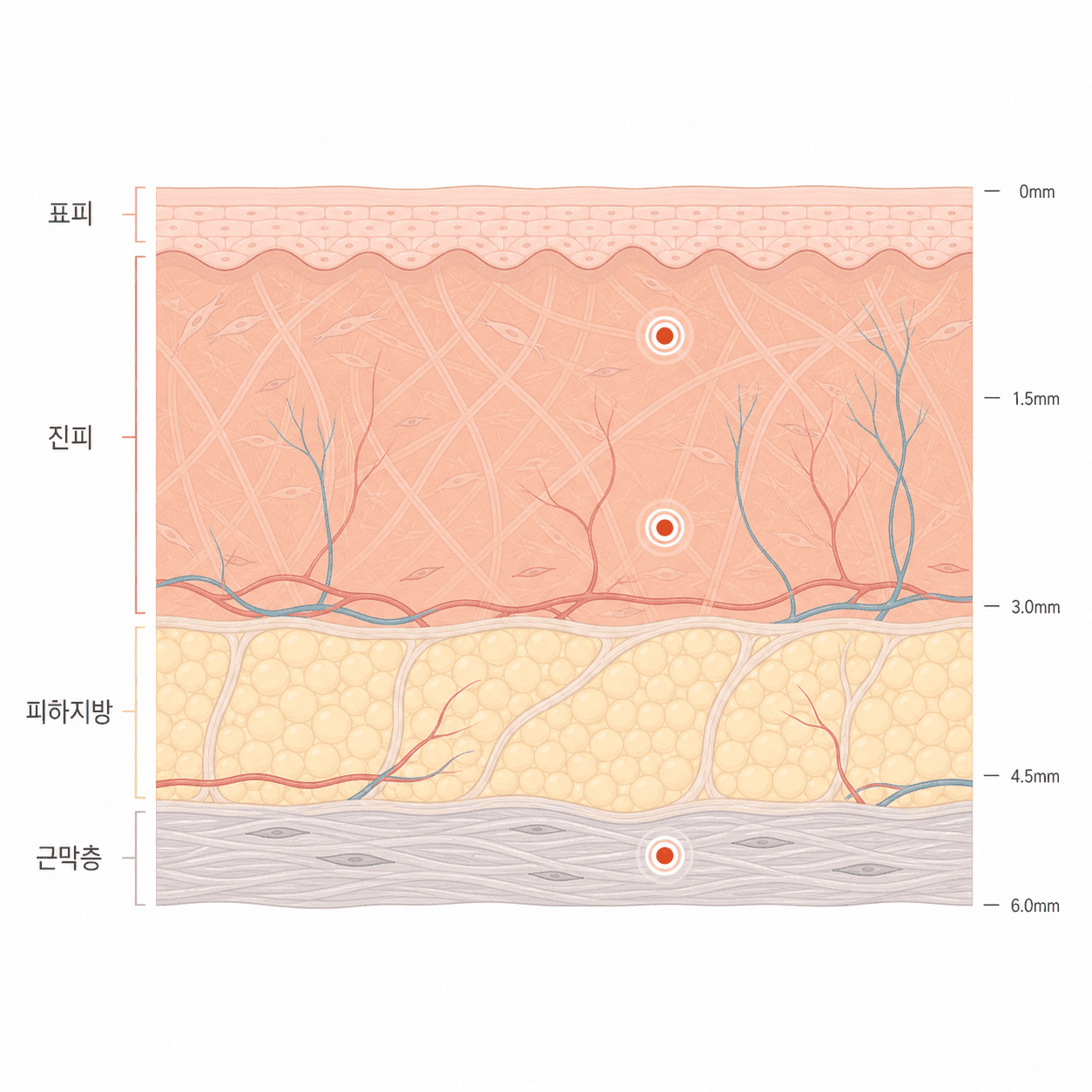 초음파 에너지가 모이는 깊이별 자리