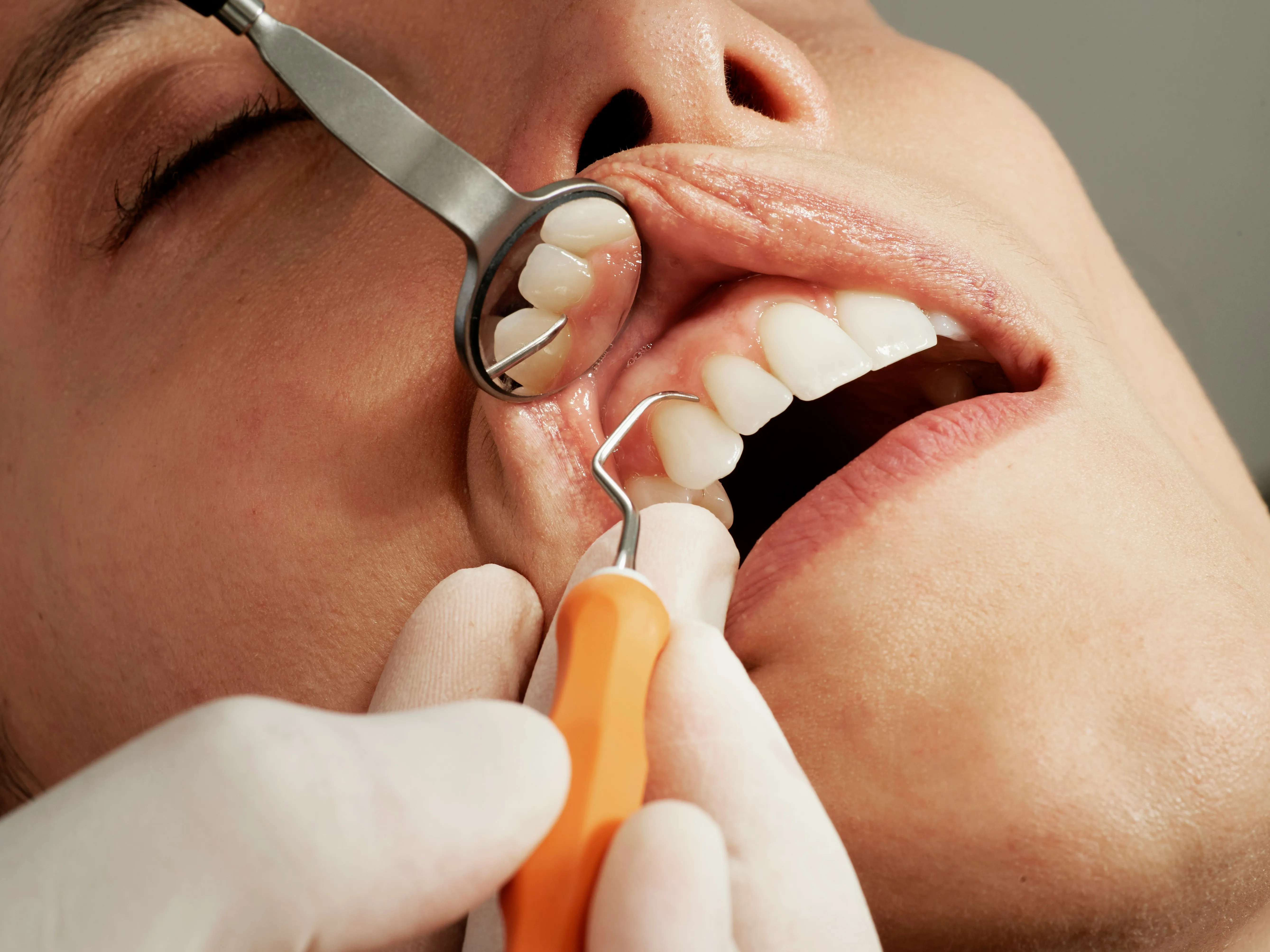 A woman having her teeth examined at Midtown Dental Studio on Eglinton in Midtown Toronto, Ontario