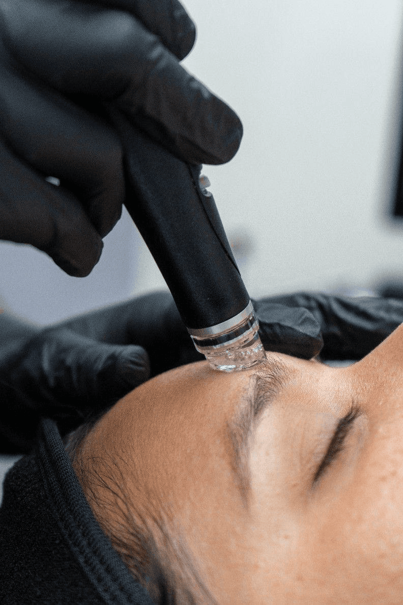 Hydrafacial® Platinum en Terrassa, Barcelona. En Heaven Clinics
