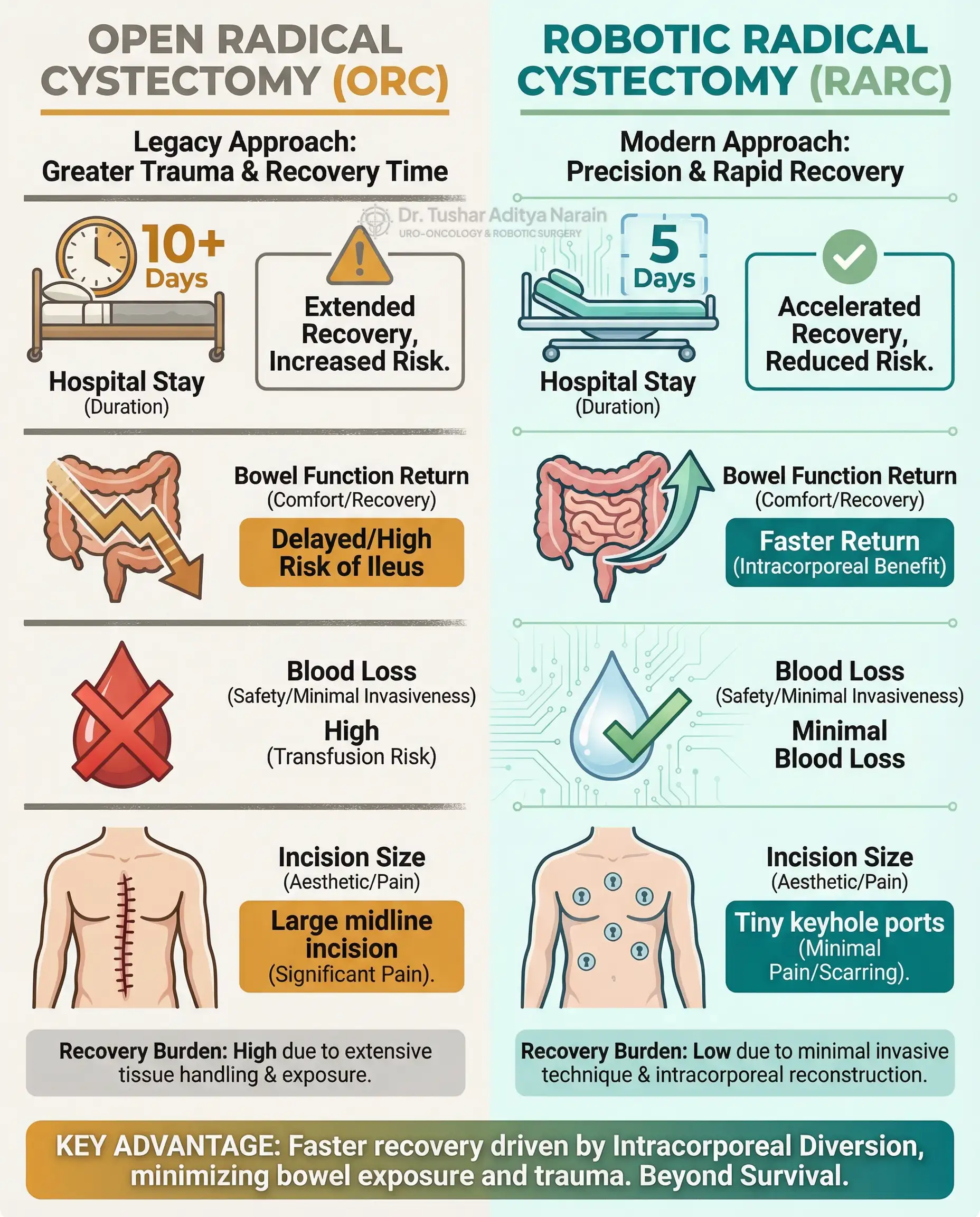 मात्रात्मक तुलनात्मक इन्फोग्राफिक जो ऑपरेशन के बाद की recovery दिखाता है। यह Robotic Radical Cystectomy (RARC) के clinical लाभों को open surgery के मुकाबले में दर्शाता है, जिसे hospital में significantly कम दिन (5 दिन) रुकना, रक्त की हानि कम होना, जल्दी bowel function का वापस आना और छोटे keyhole incisions विशेष रूप से Intracorporeal Urinary Diversion तकनीक के कारण संभव है।