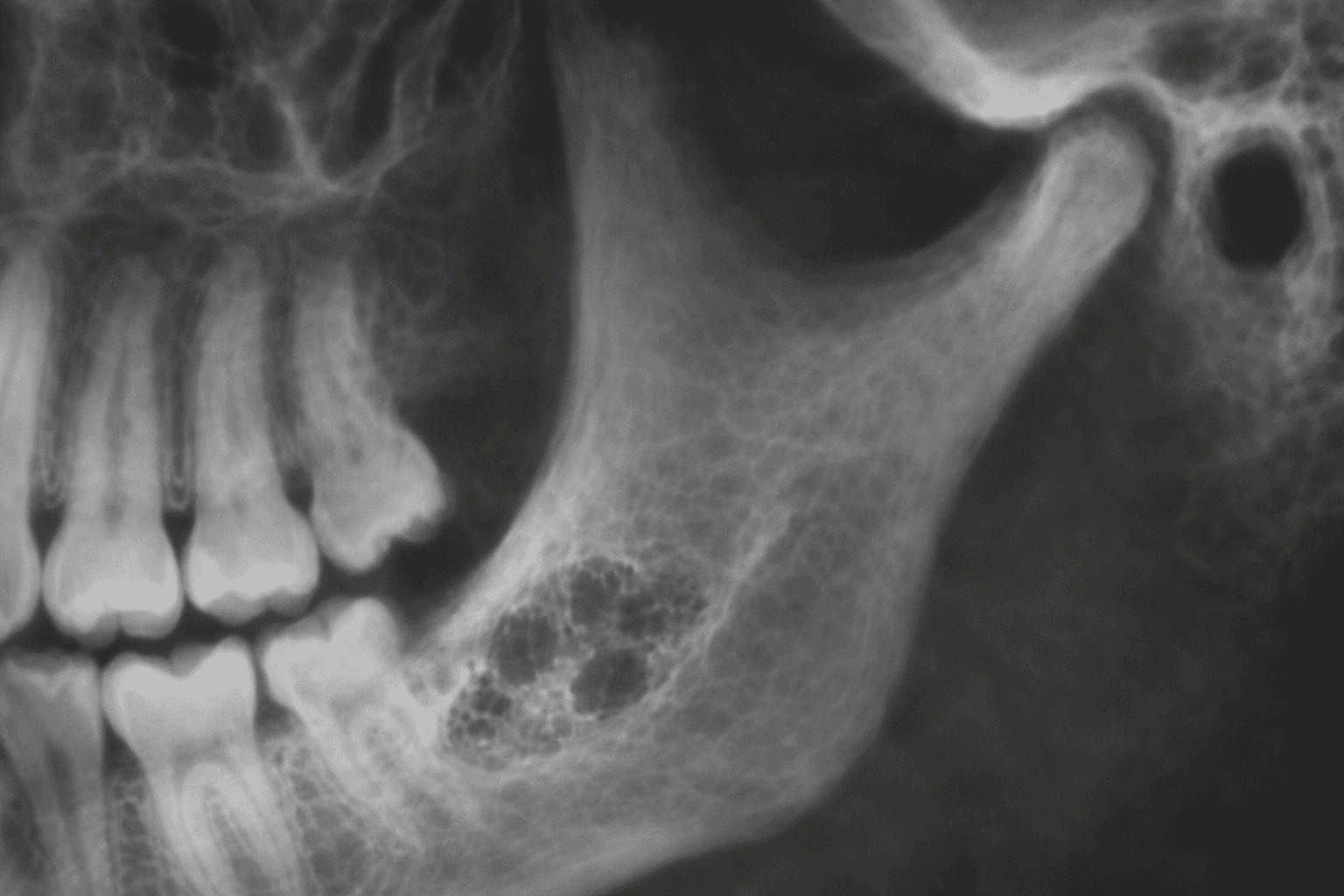 Posture and alignment changes after treatment