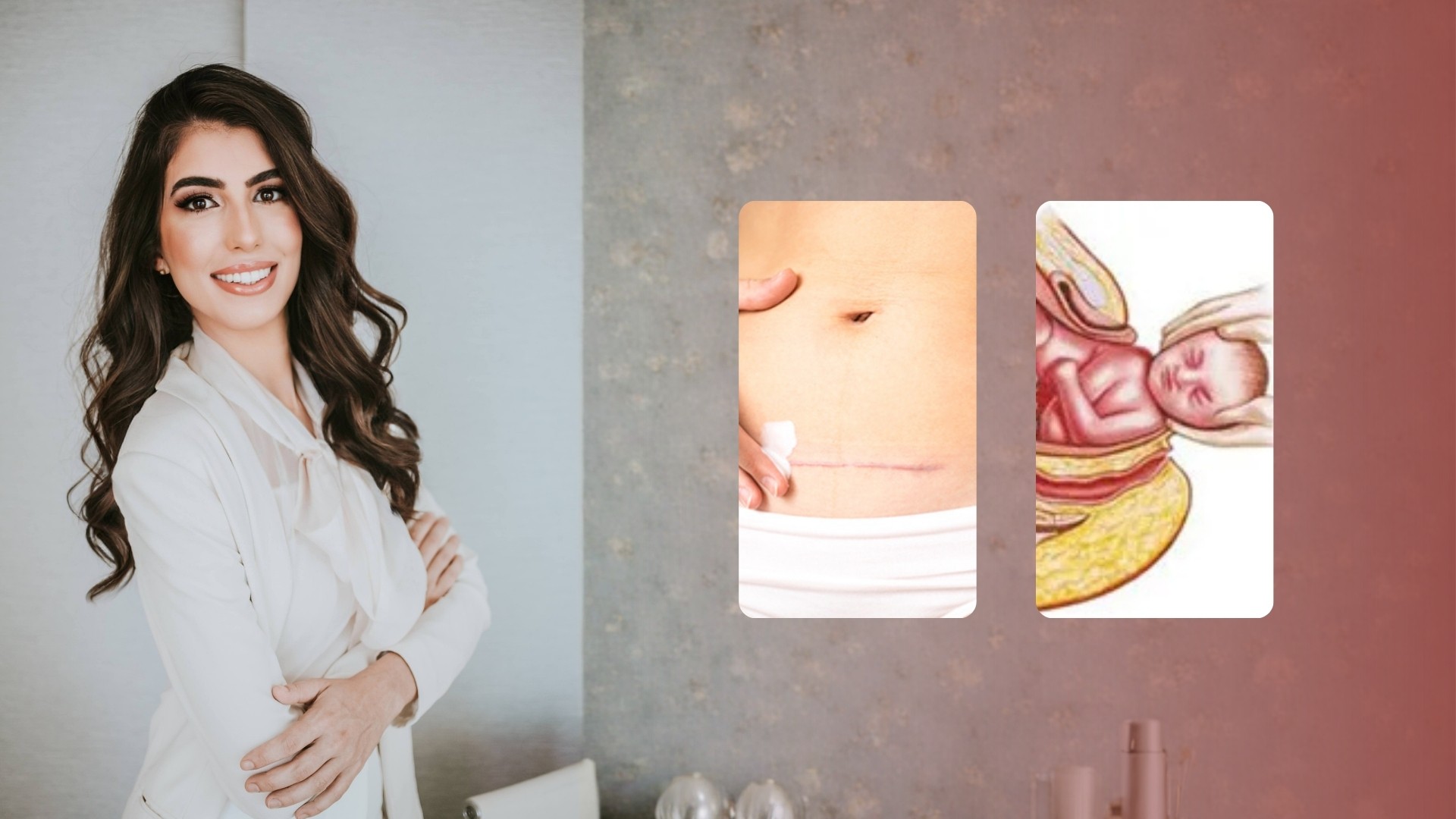 modulo parto normal e cesariana