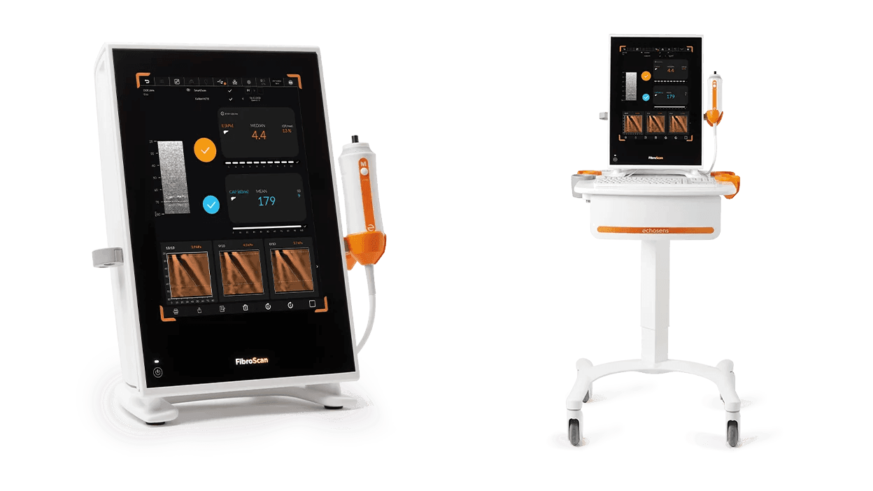 Photo of the FibroScan 530.