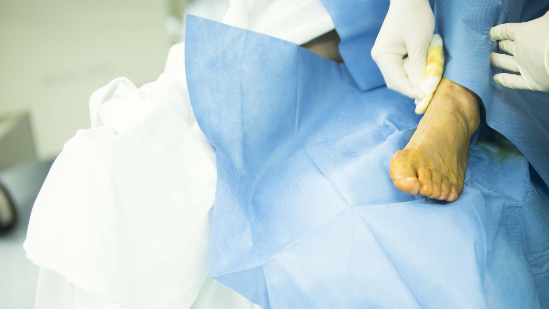 Ankle Arthroscopy