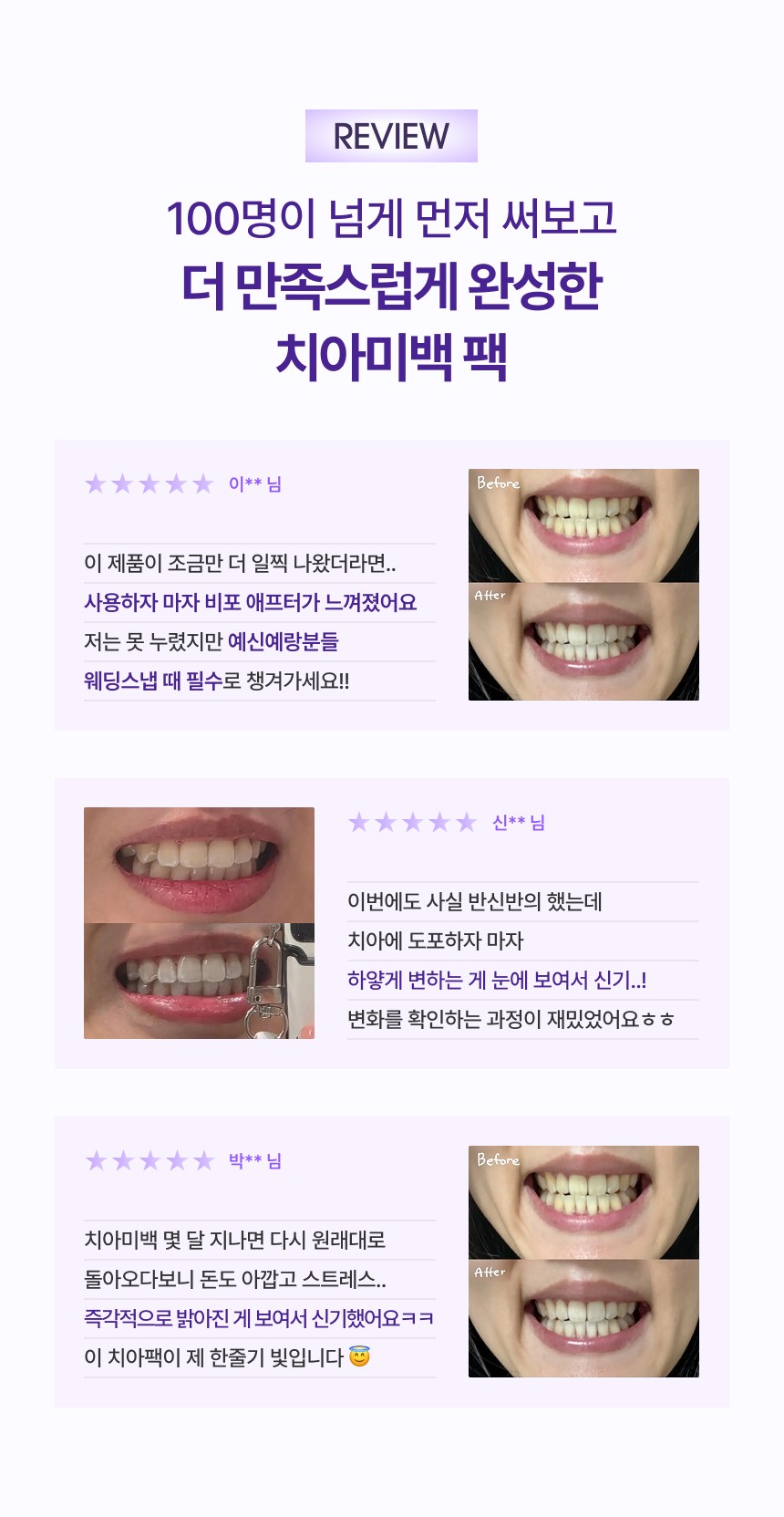 코티브 흑미 치아미백 팩 사용 후기를 소개하는 이미지