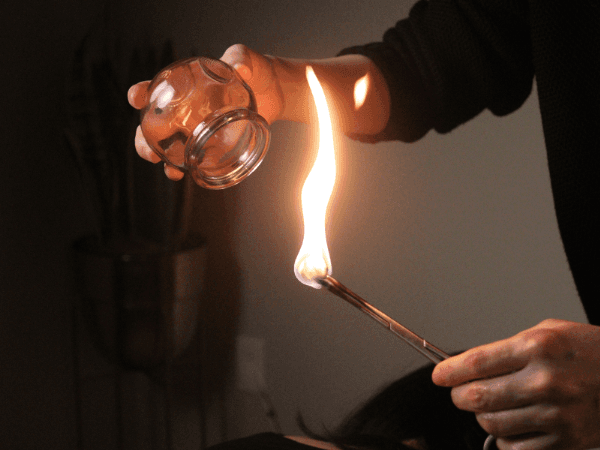 acupuncurist lighting up a fire cup for therapy