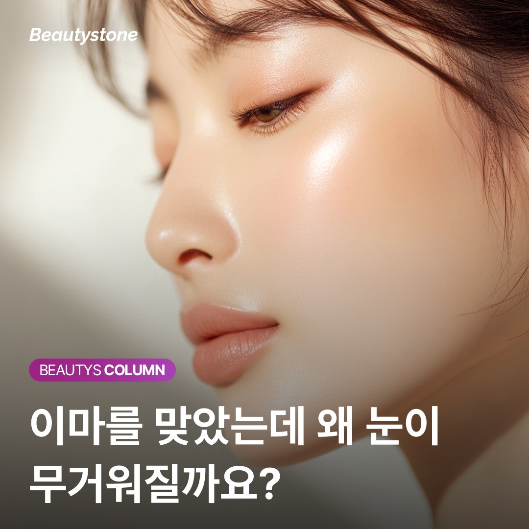 코어톡스와 이마 보톡스: 정밀한 확산 제어로 눈꺼풀 처짐을 방지하는 법