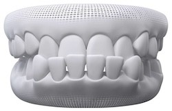 Underbite teeth