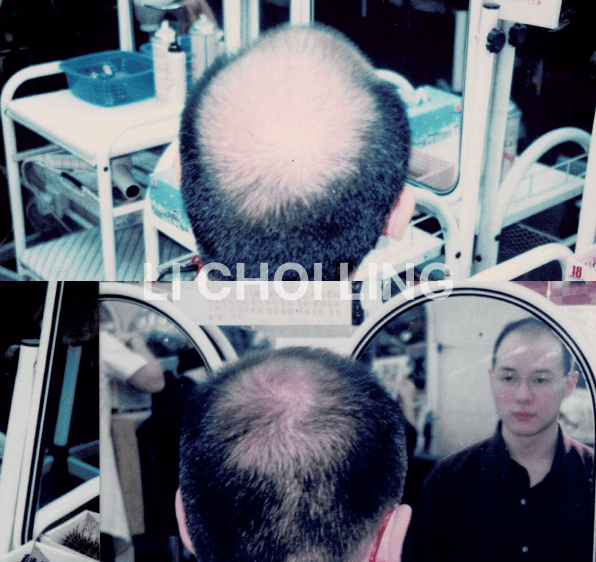 lichoiling casestudy