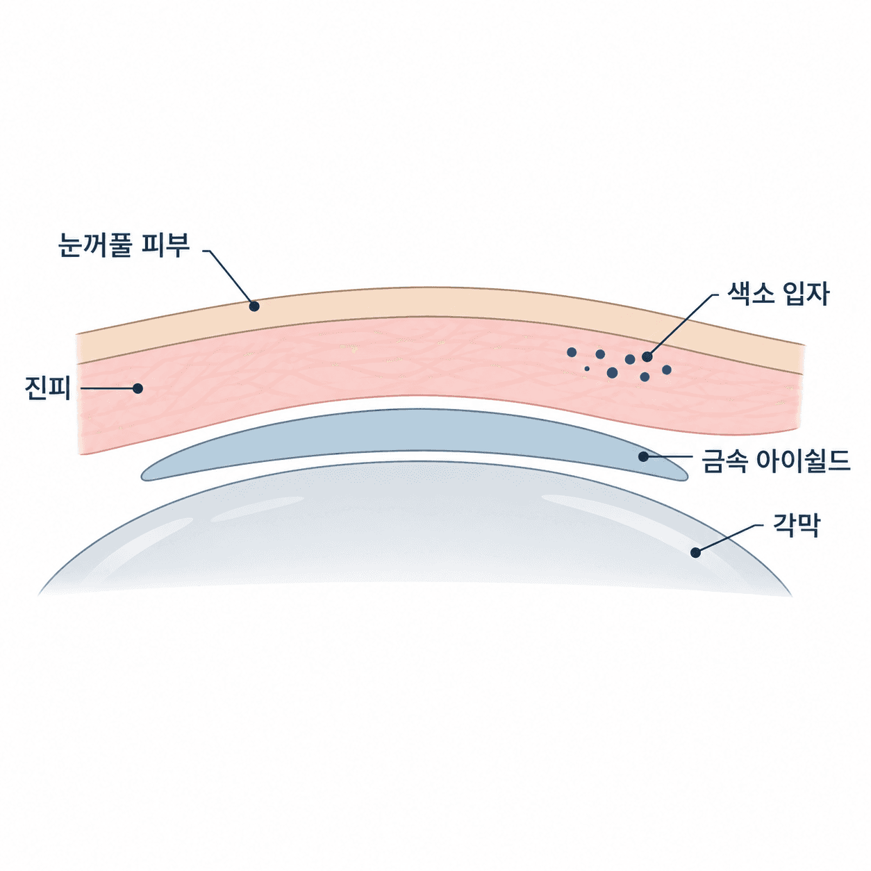 색소는 얇은 눈꺼풀 안에, 보호 장비는 그 아래 각막 위에 들어가요.