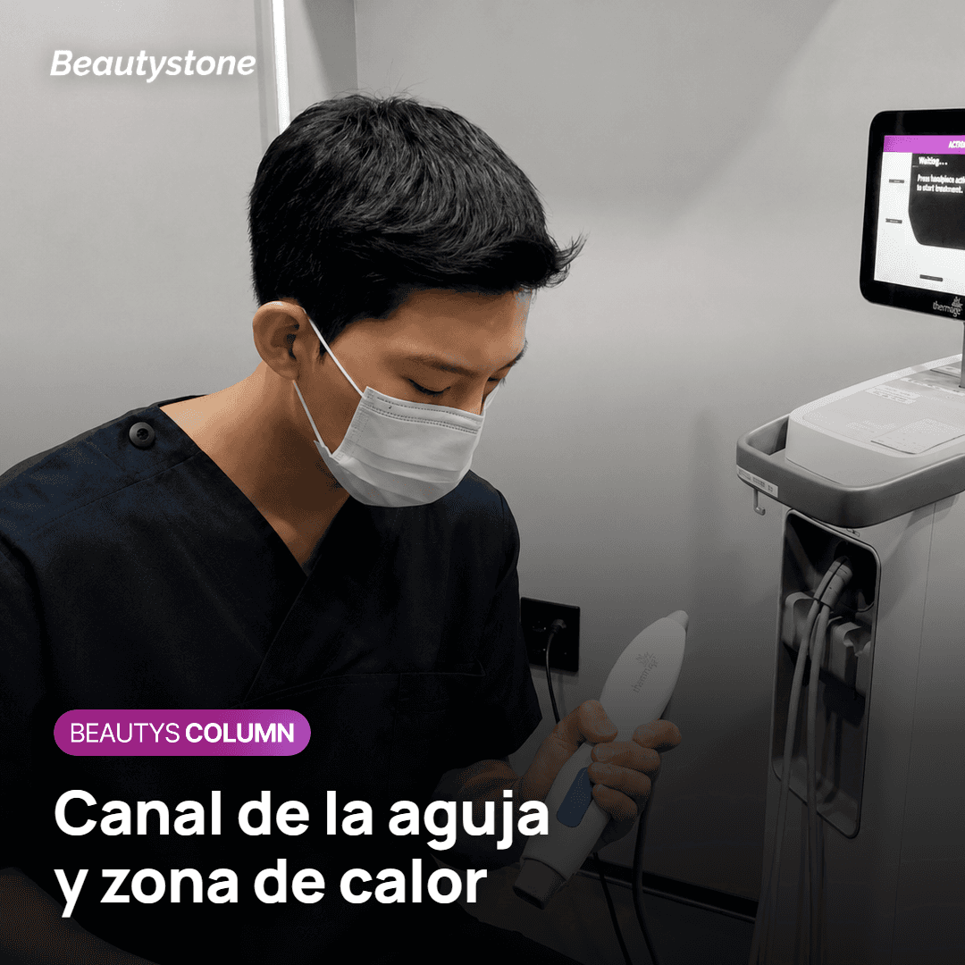 Canal de la microaguja y zona de calor de radiofrecuencia en la dermis tras Potenza