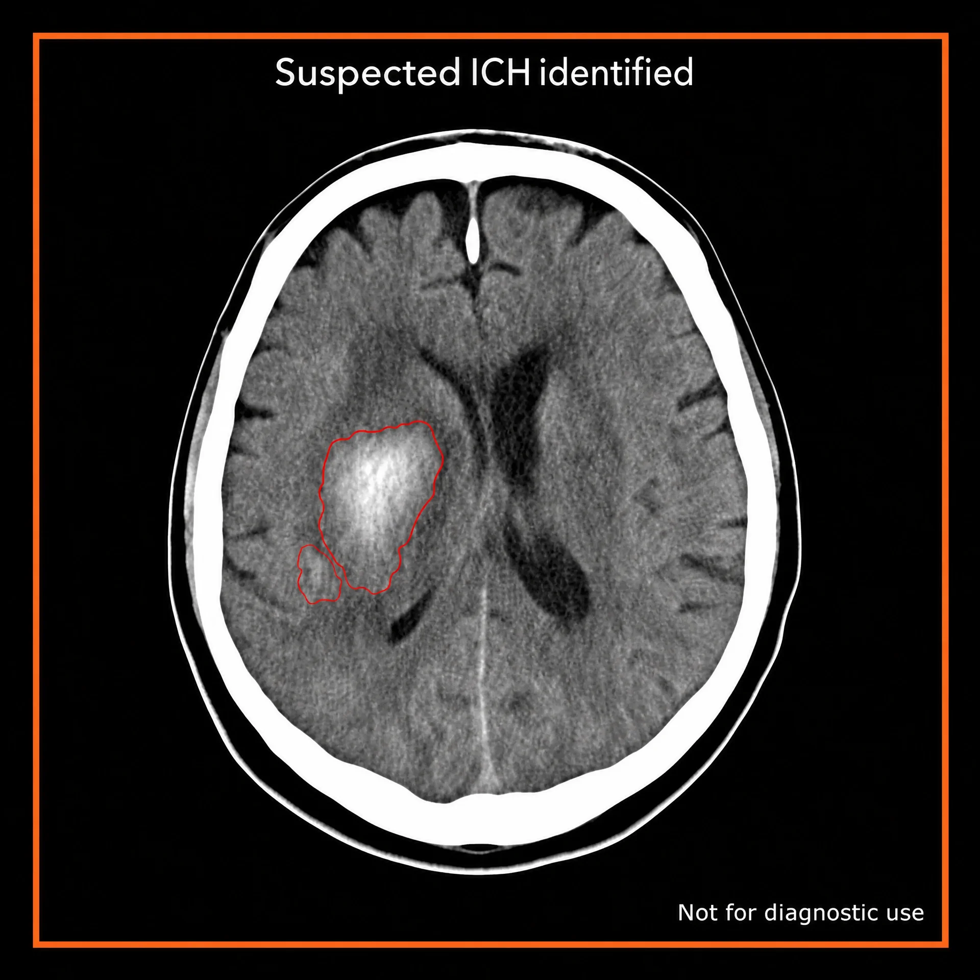 Axial non-contrast head CT