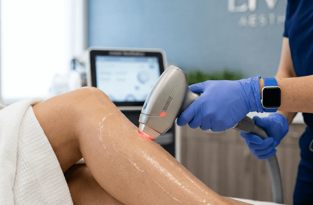 Laser Hair Reduction of the legs. 