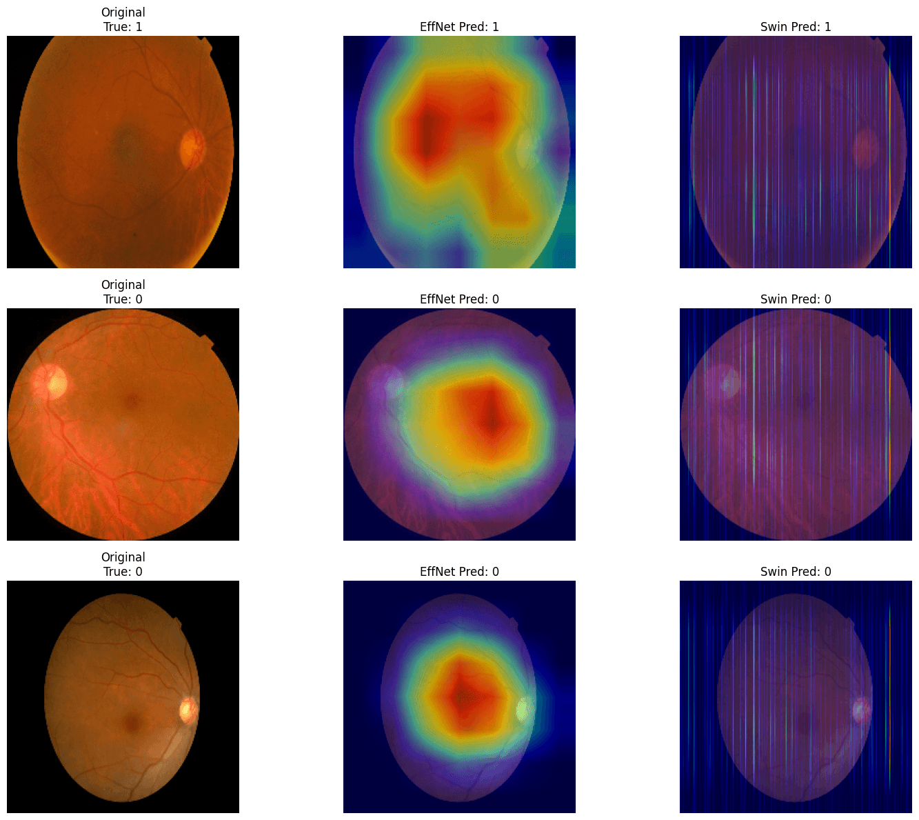 DRDetection