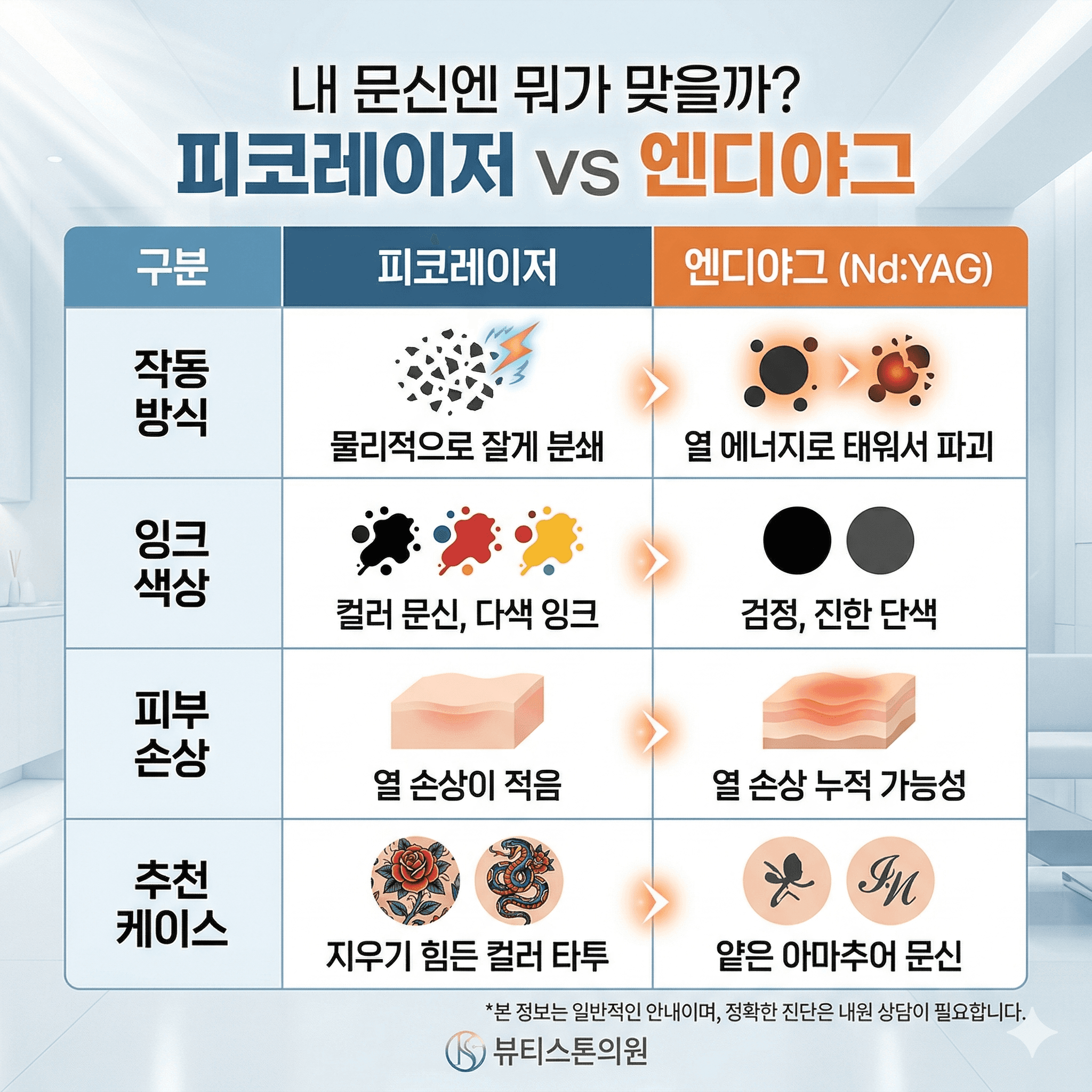 "피코는 부수고, 엔디야그는 태웁니다" 내 문신에 맞는 레이저 찾는 법