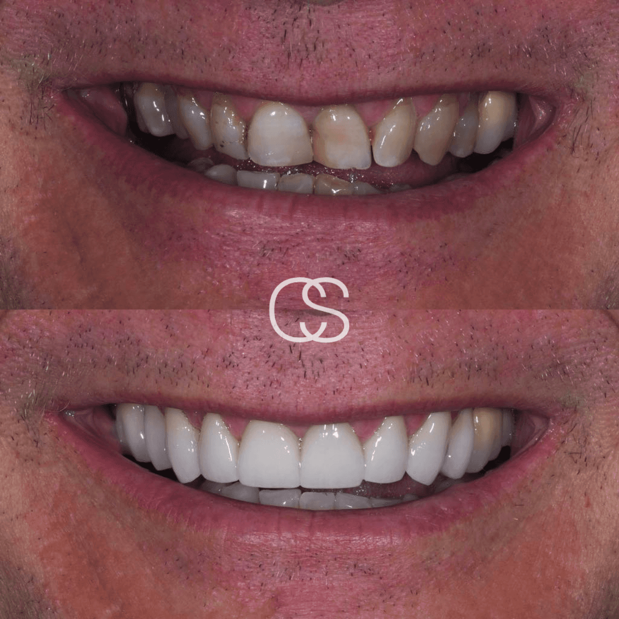 Before & After