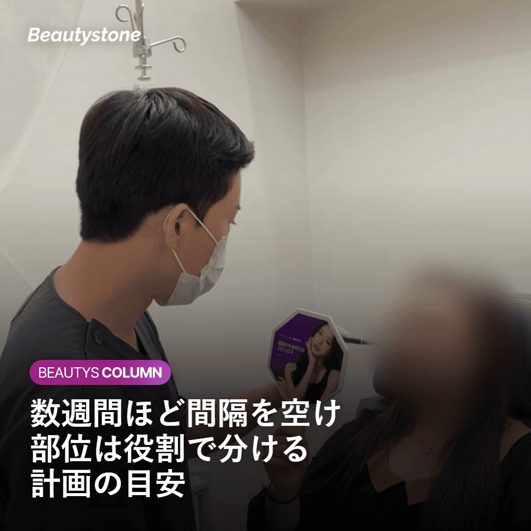 ボリュームと肌質ケアの間隔と部位の分け方の目安を示す図