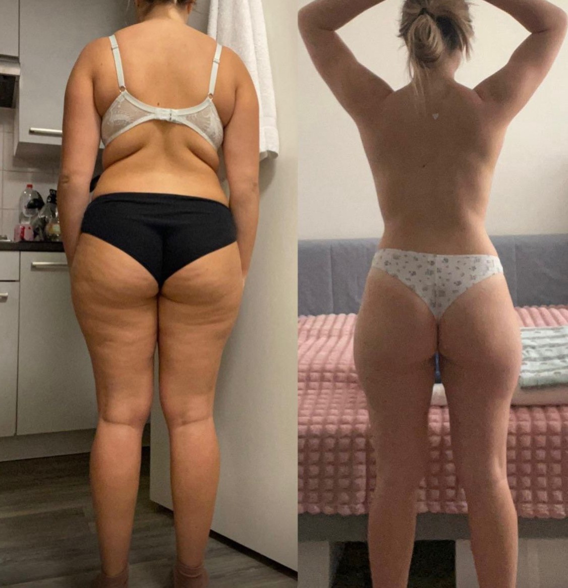 Transformation Photo