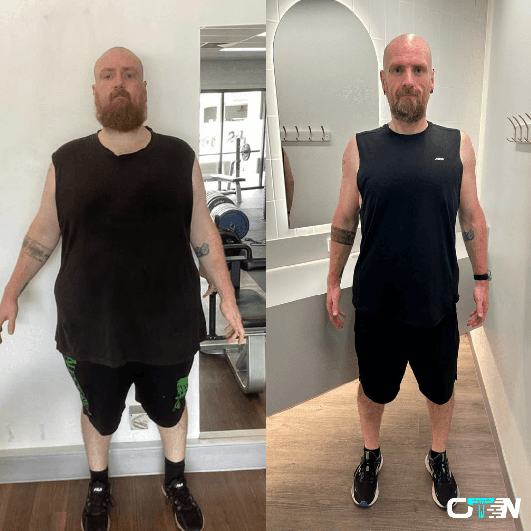 Transformation Photo