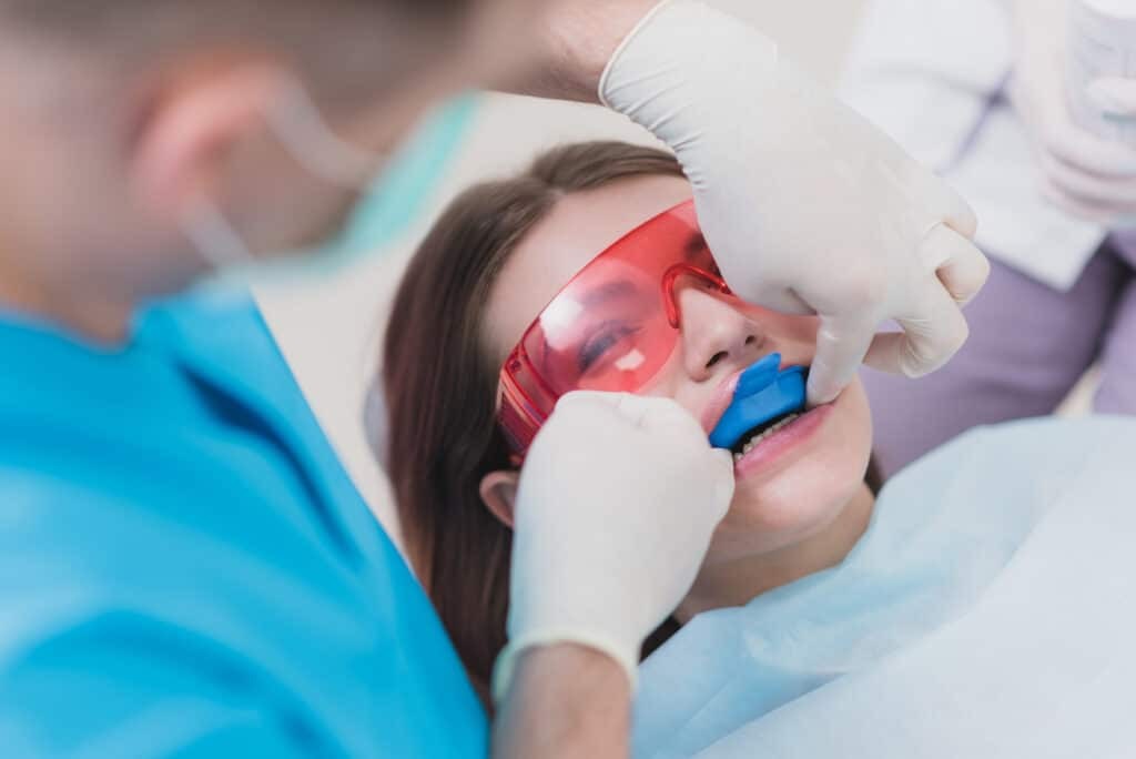 fluoride treatment