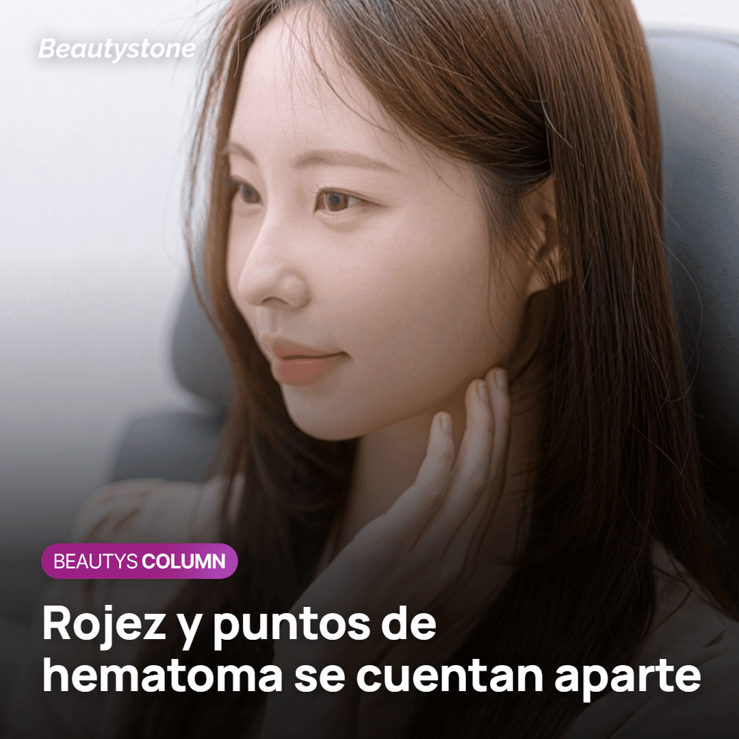 Duración del enrojecimiento después de Potenza