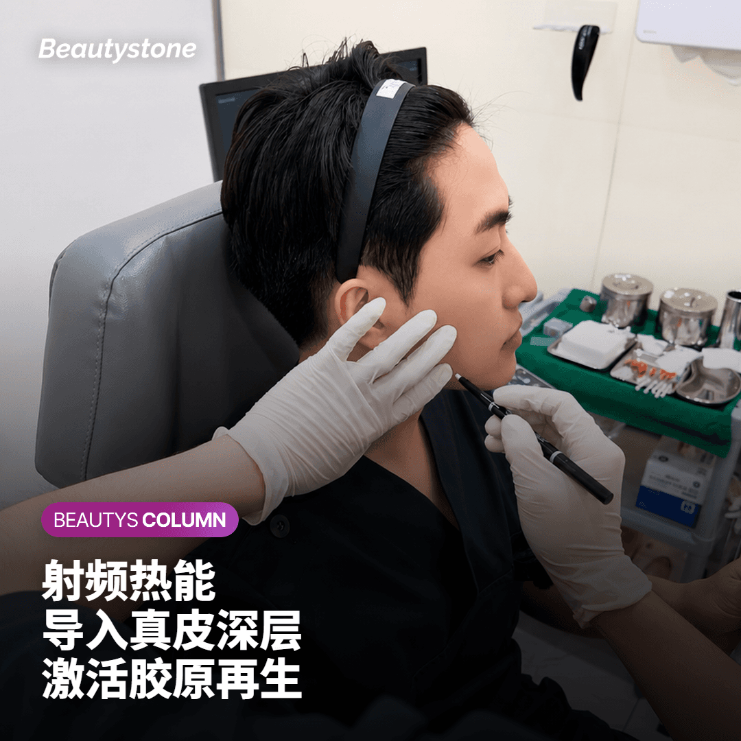 一般建议做几次？不同情况下的疗程规划
