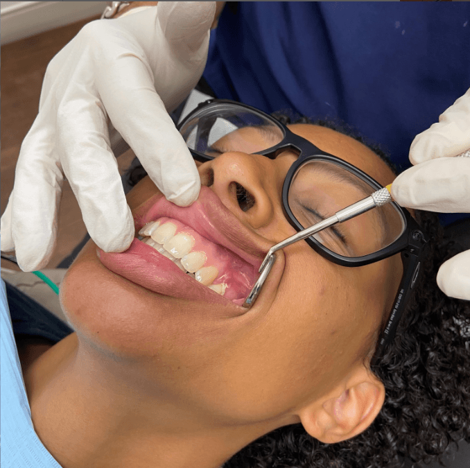 Gum Grafting at ScarboroSmiles Dental Clinic in Scarborough, ON | Best dentist in Scarborough.
