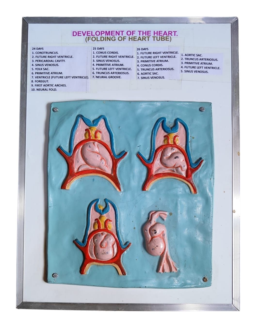 Development of the Heart (Folding of Heart Tube)