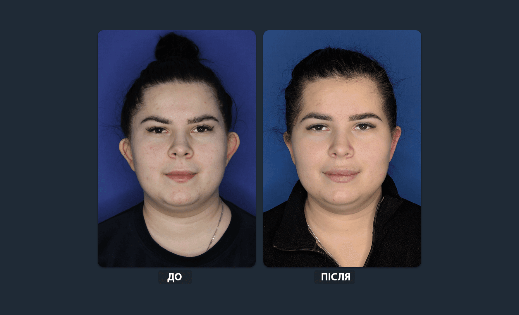 Patient photo 1