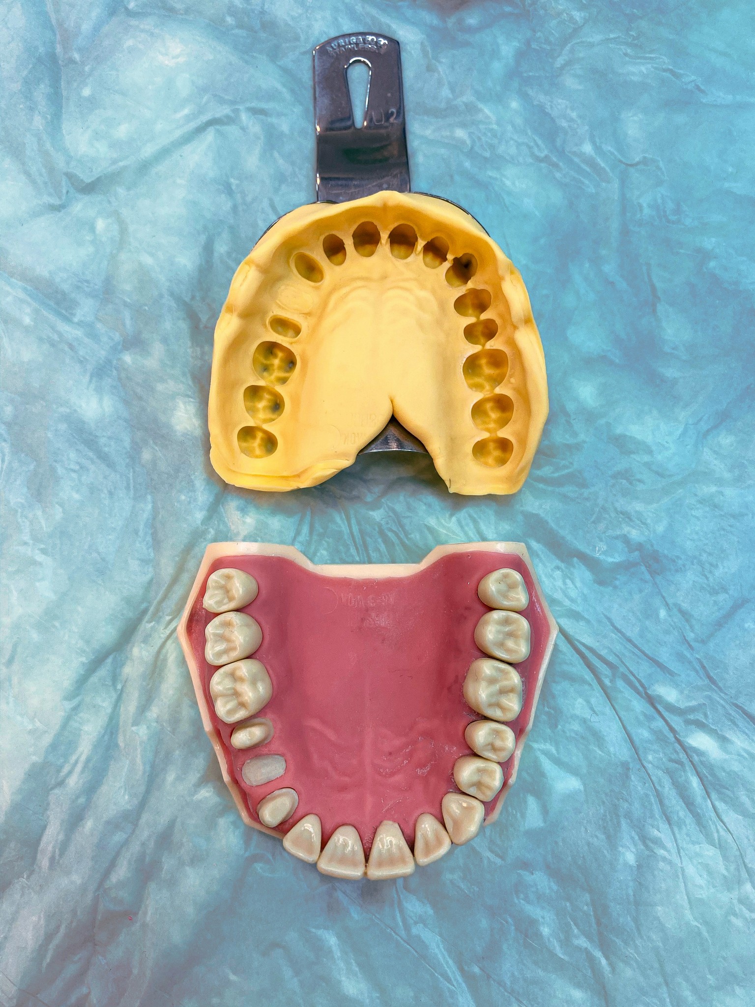 partial denture