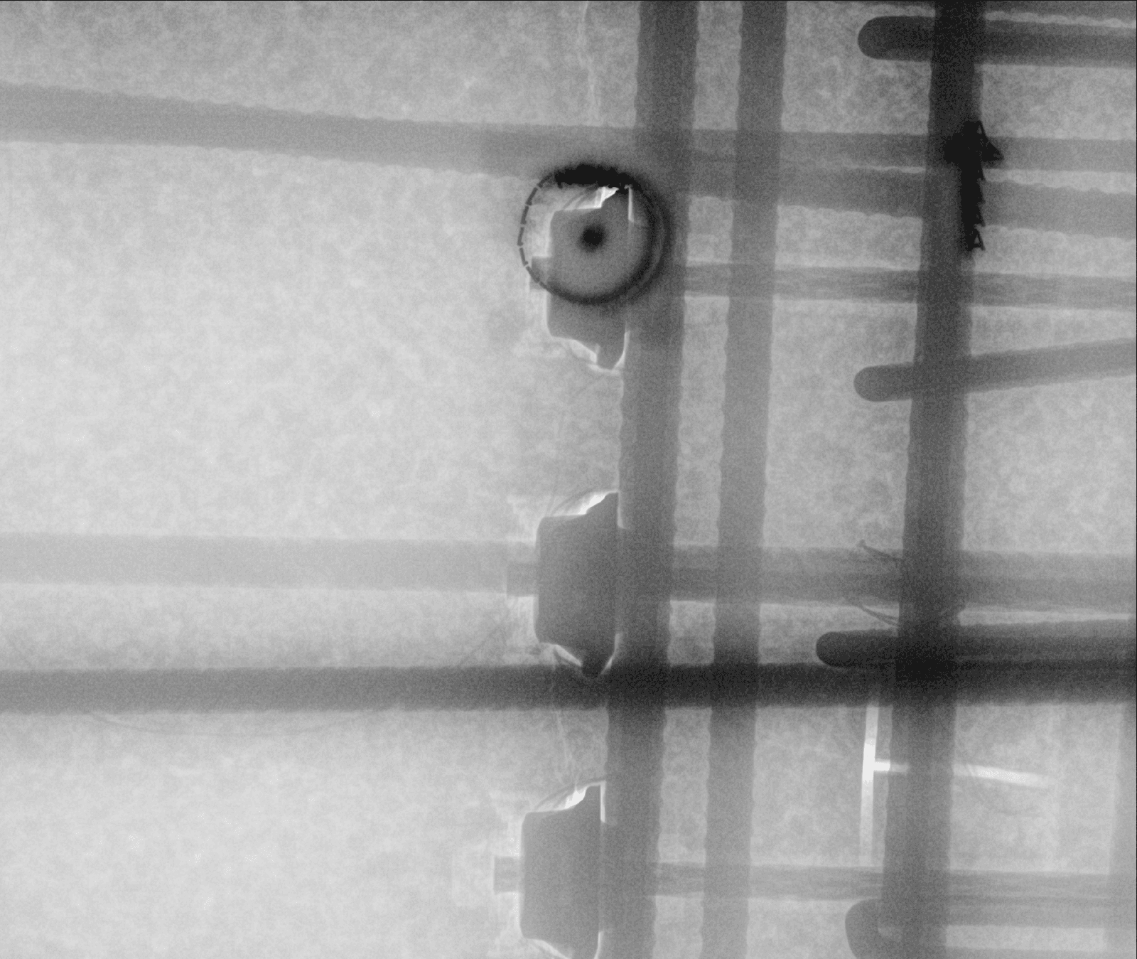 A close-up of a radiograph
AI-generated content may be incorrect.