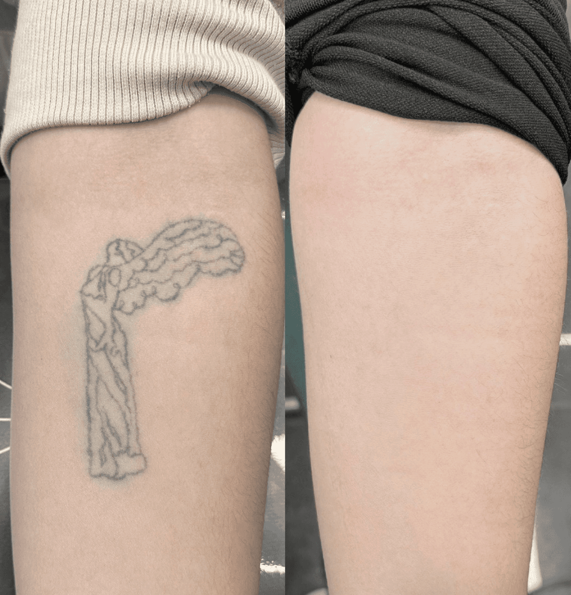 Haarausfall Männer Schweiz