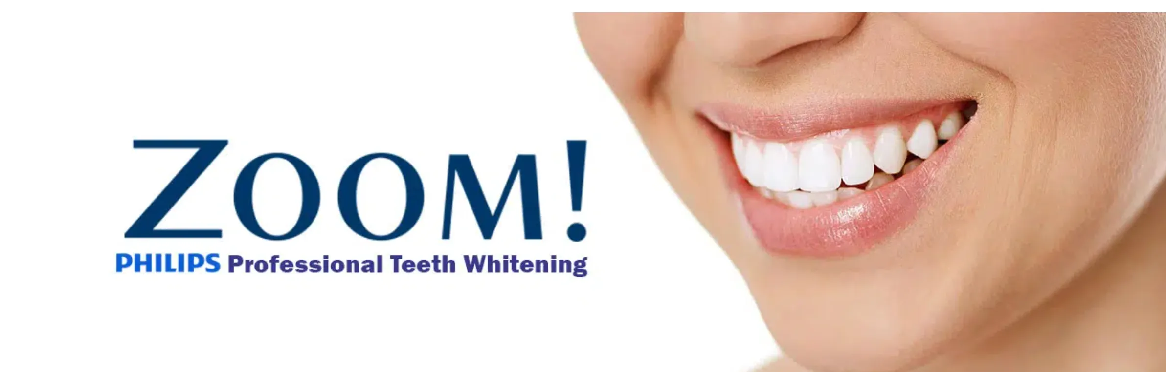 Professional teeth whitening treatment