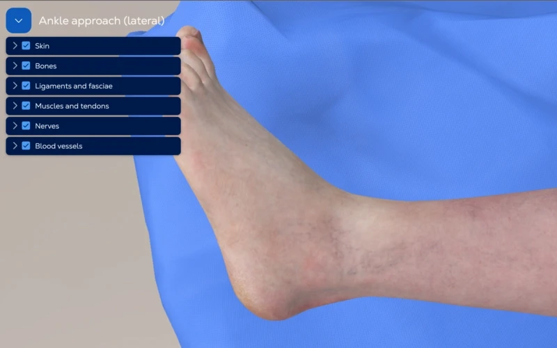 Ankle approach - lateral