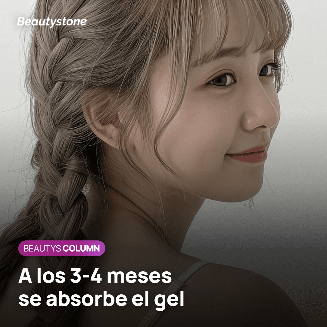 Absorción del gel de Radiesse a los 3 o 4 meses