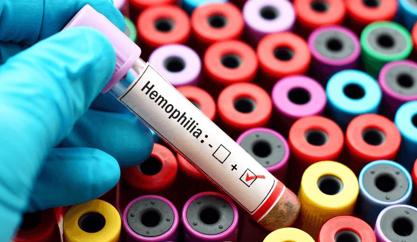 Biotechnology in India, Gene Therapy Innovations, Haemophilia Treatment. Close-up of a hand holding a blood sample vial labeled 'Hemophilia Test,' representing medical diagnostics for hemophilia.