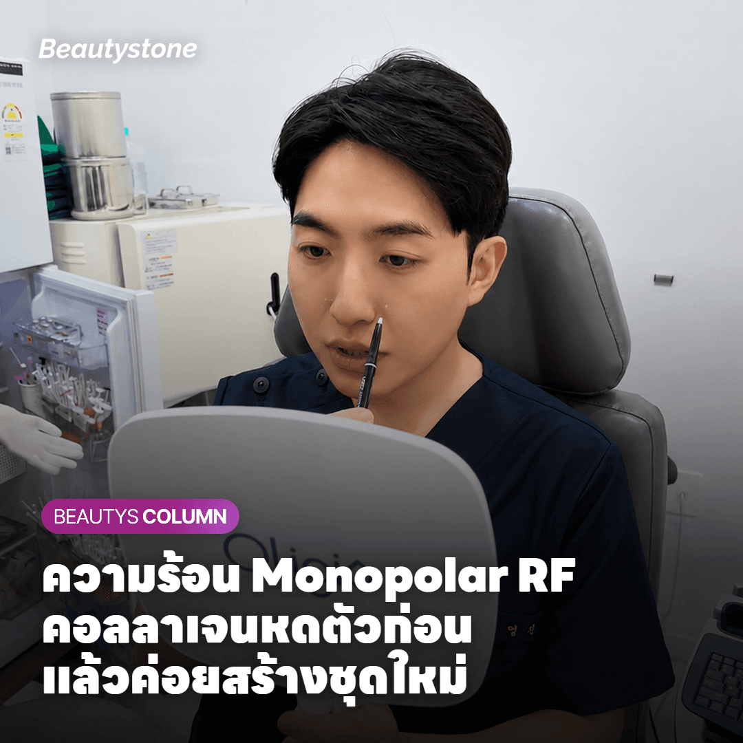 ภาพอธิบายความร้อน Monopolar RF ที่ทำให้คอลลาเจนหดตัวแล้วค่อยสร้างใหม่