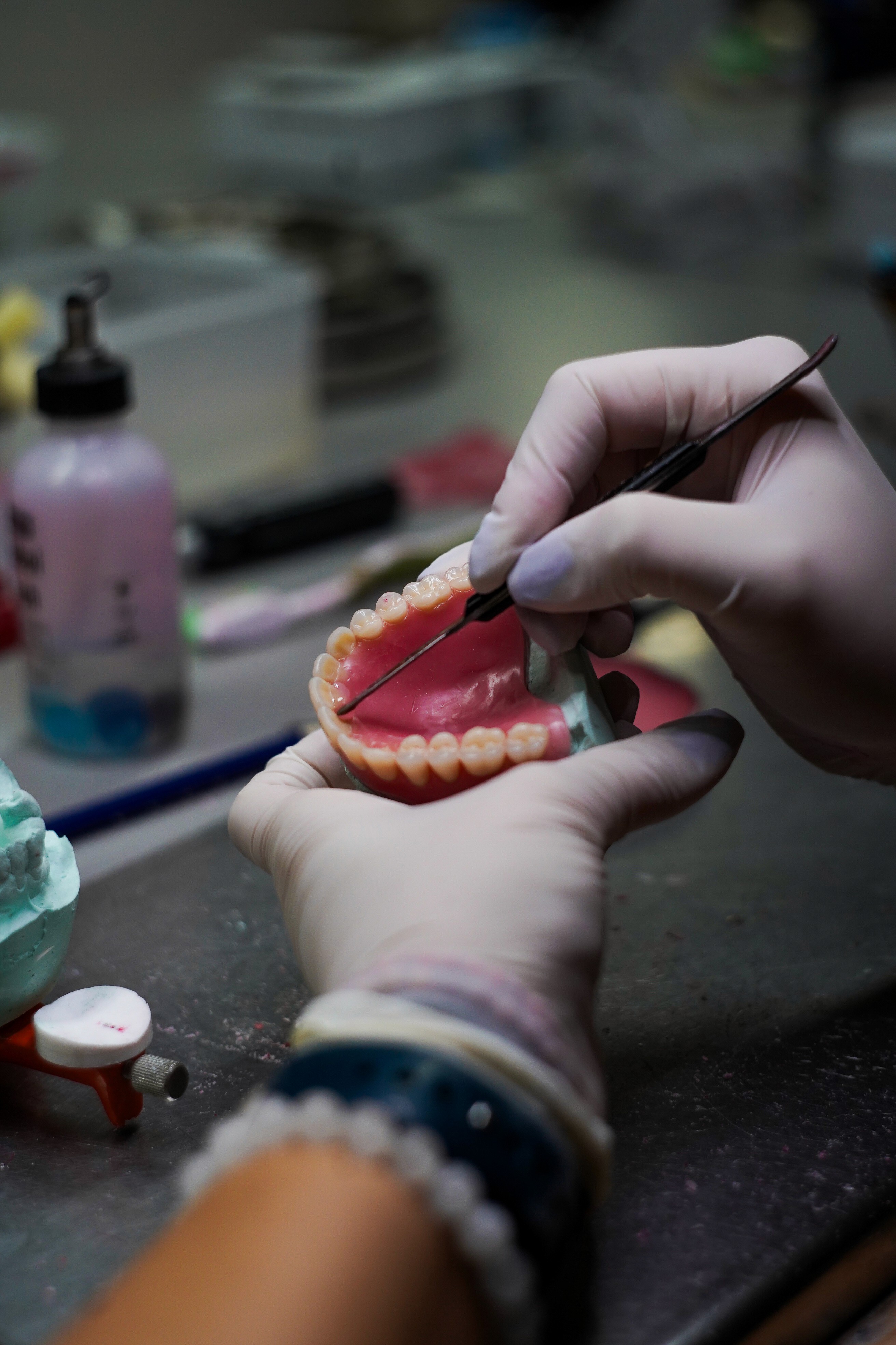 Kontrola kvality zubnej náhrady – overenie presnosti a estetiky pred odoslaním